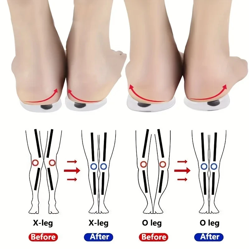 1Pair Orthopedic Insoles for F - Women Shoes Types recension och pris
