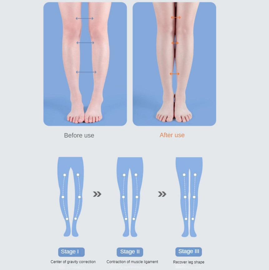 PU Orthotic Insole Arch Suppor - Women Shoes Types recension och pris